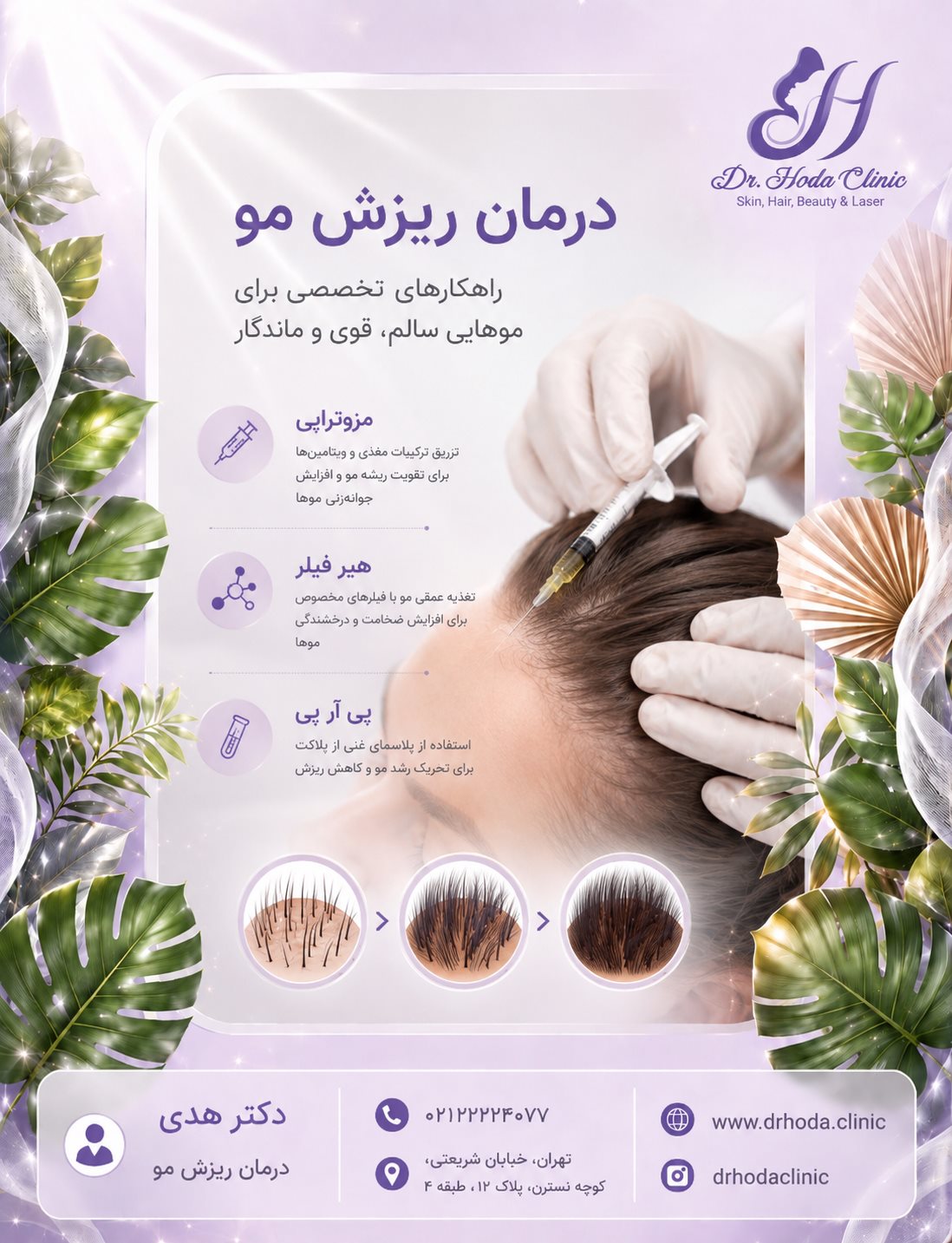 درمان ریزش مو