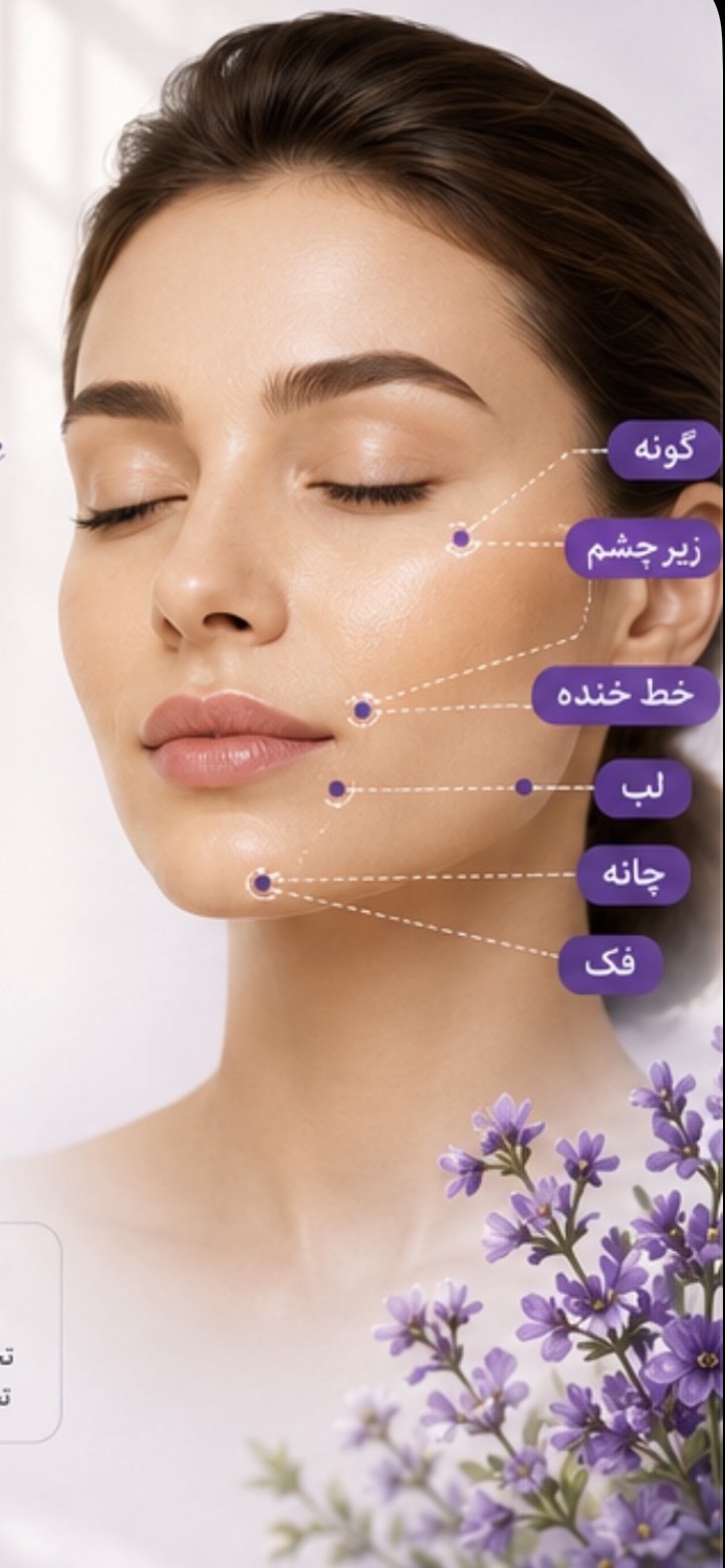 فیلر 