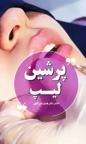 تزریق ژل لب پرشین