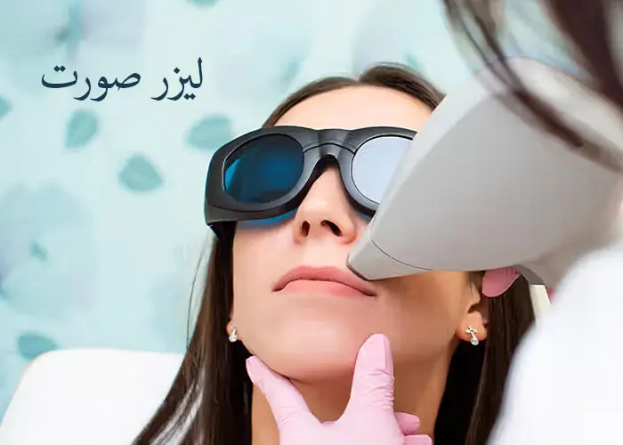 لیزر صورت