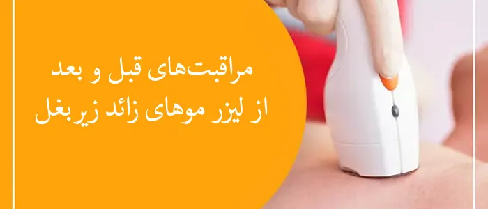 مراقبت‌های قبل و بعد از لیزر موهای زائد زیربغل
