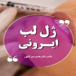 ژل لب ایرونی