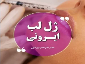 ژل لب ایرونی