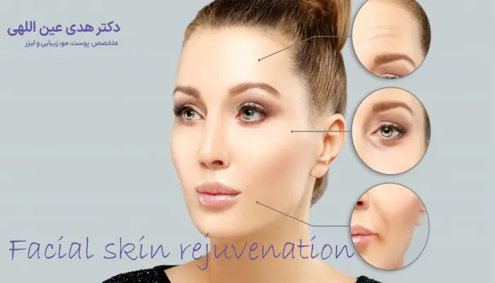 Facial skin rejuvenation