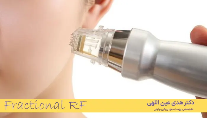 آر اف فرکشنال 