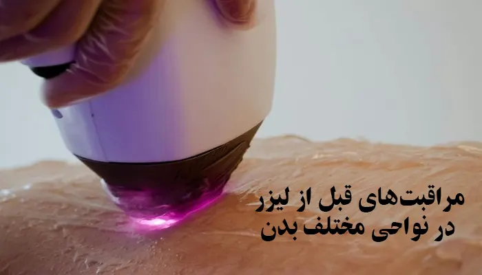 مراقبت‌های قبل از لیزر در نواحی مختلف بدن