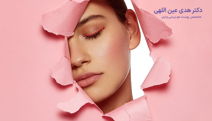 عوارض شایع لیزر صورت