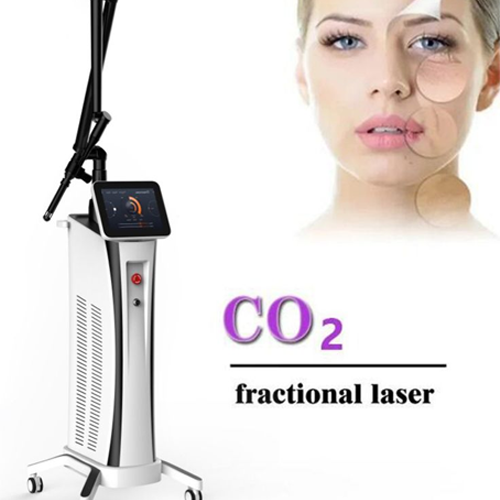 مزایای استفاده از لیزر CO2 فرکشنال آنجلا 