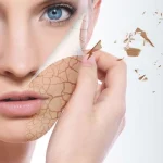 بوتاکس برای چه کسانی ضرر دارد؟