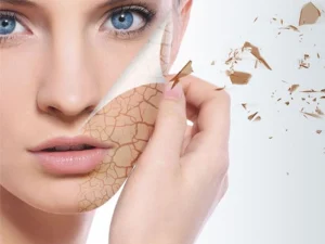 بوتاکس برای چه کسانی ضرر دارد؟