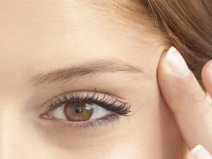 بوتاکس چشم گربه‌ای