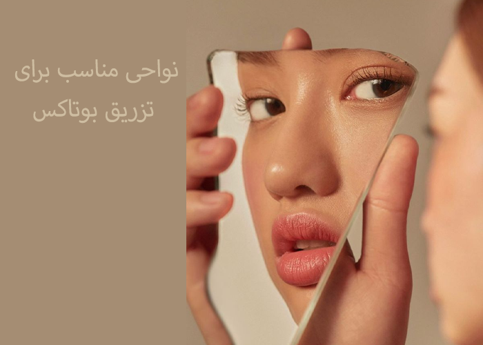 مناطق مناسب برای تزریق بوتاکس