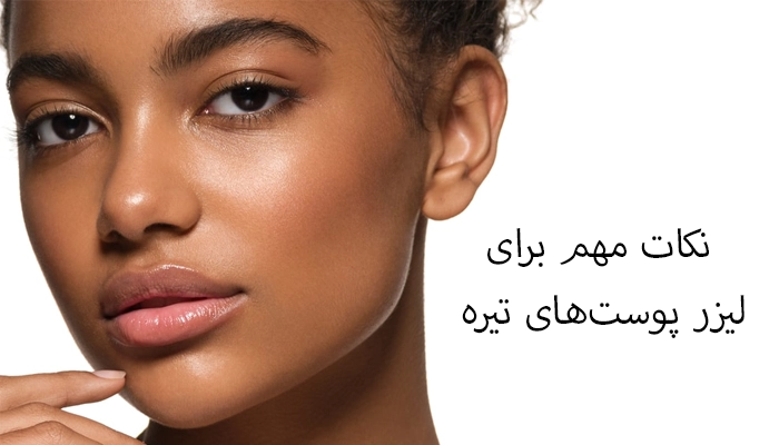 نکات مهم برای لیزر پوست‌های تیره