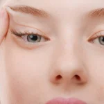 هزینه بوتاکس چشم گربه‌ ای