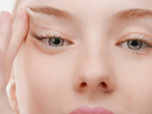 هزینه بوتاکس چشم گربه‌ ای