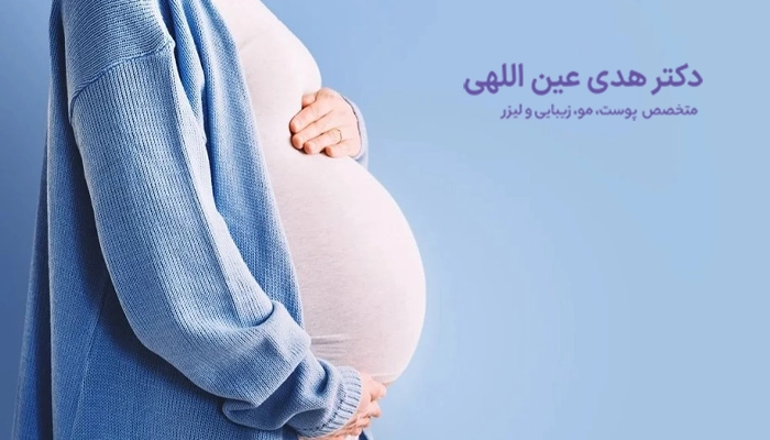 لیزر موهای زائد و تاثیر آن بر هورمون‌های بدن