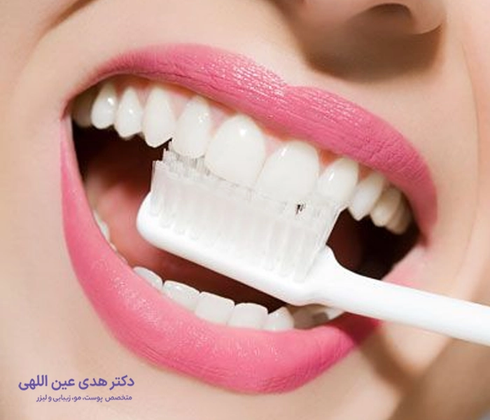 تمیز کردن دندان‌ها بعد از تزریق ژل لب