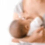 لیزر موهای زائد برای کودک در دوران شیردهی