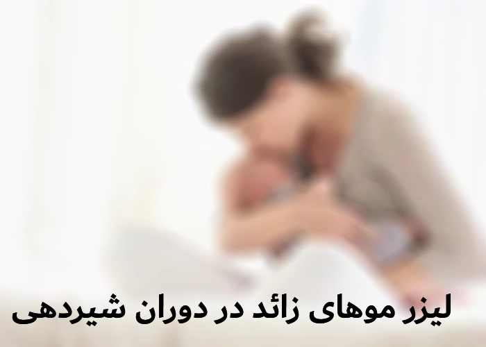 لیزر موهای زائد در دوران شیردهی