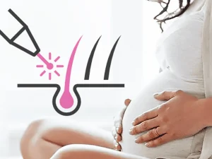 آیا لیزر موهای زائد برای زنان باردار مناسب است؟