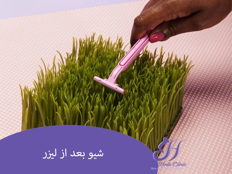 شیو بعد از لیزر