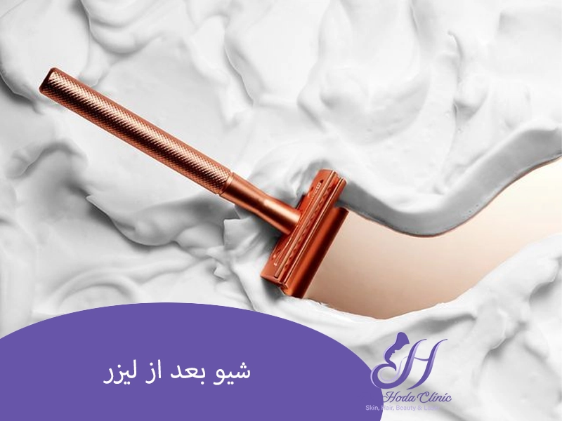شیو کردن بعد لیزر