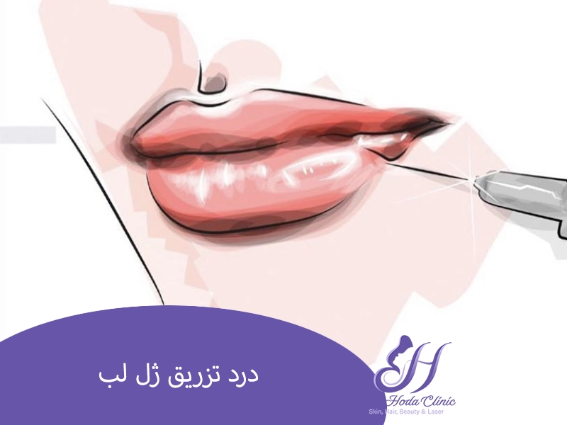 درد تزریق ژل لب
